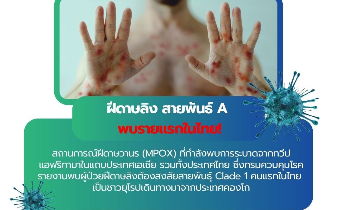 ฝีดาษลิง สายพันธ์ A พบรายแรกในไทย!